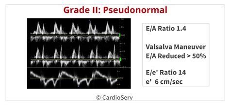 pseudonormal left ventricular filling pattern.